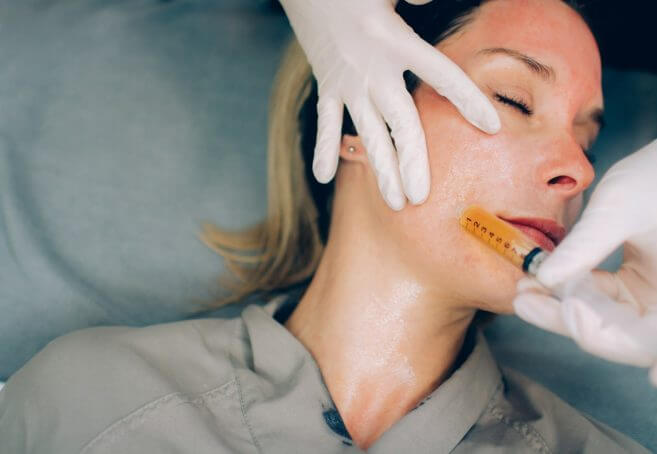 Vampire Facial Procedure in Toronto