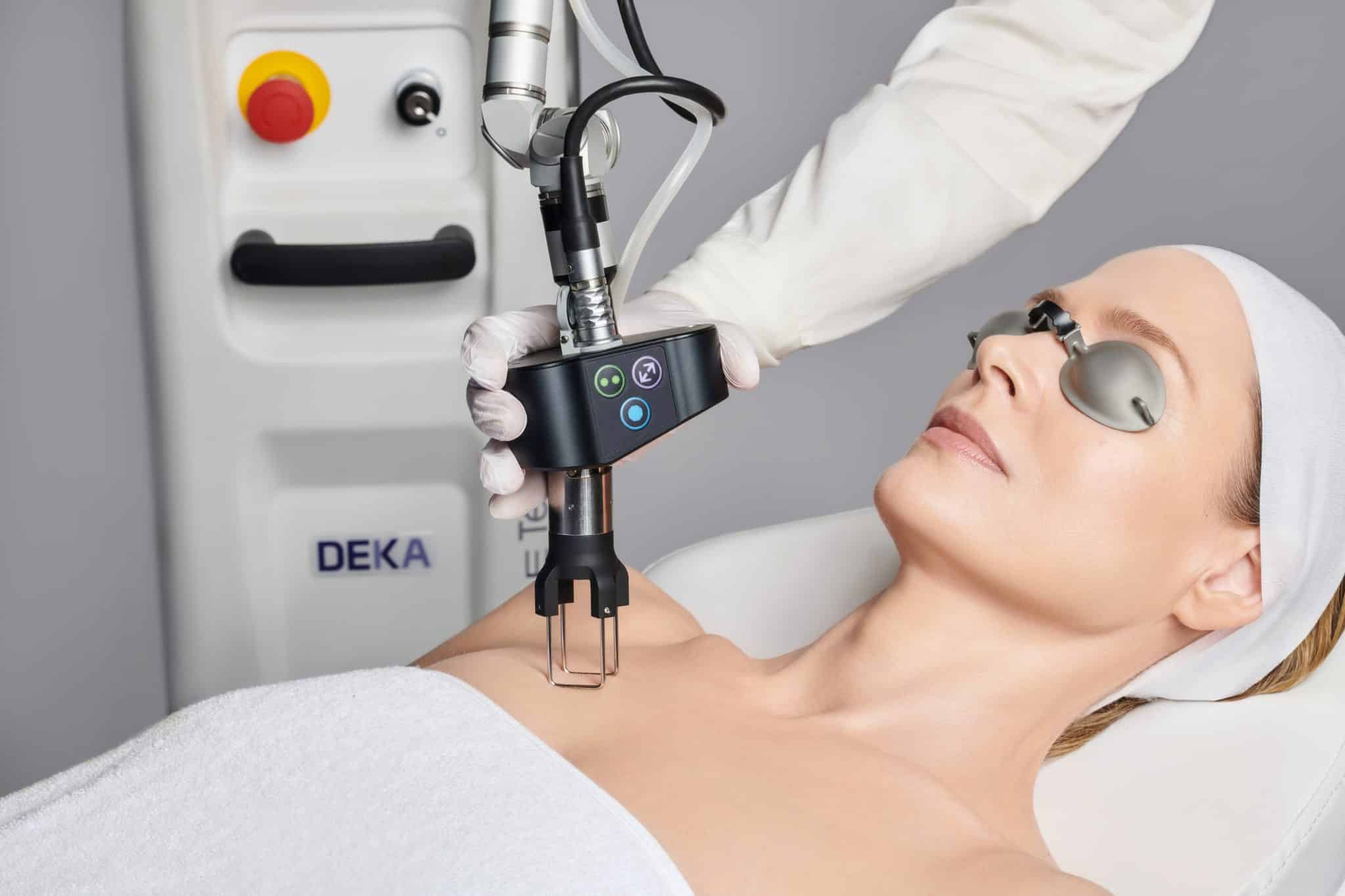 DEKA Tetra CO2 Laser