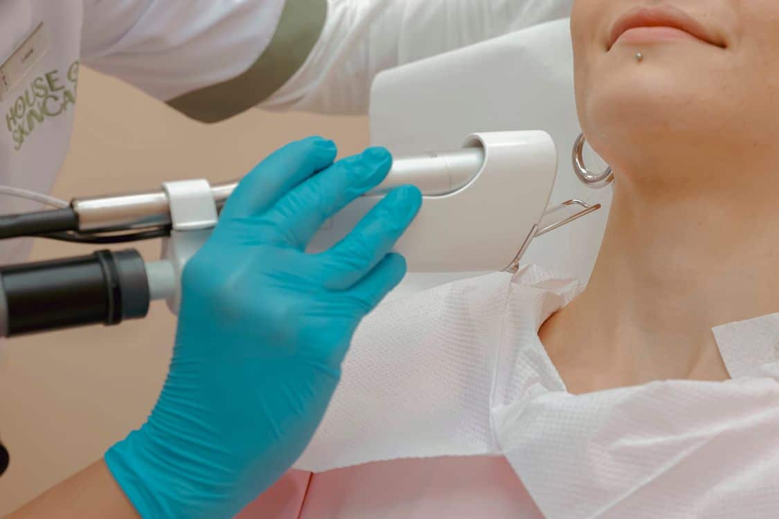 CoolPeel CO2 laser skin resurfacing treatment