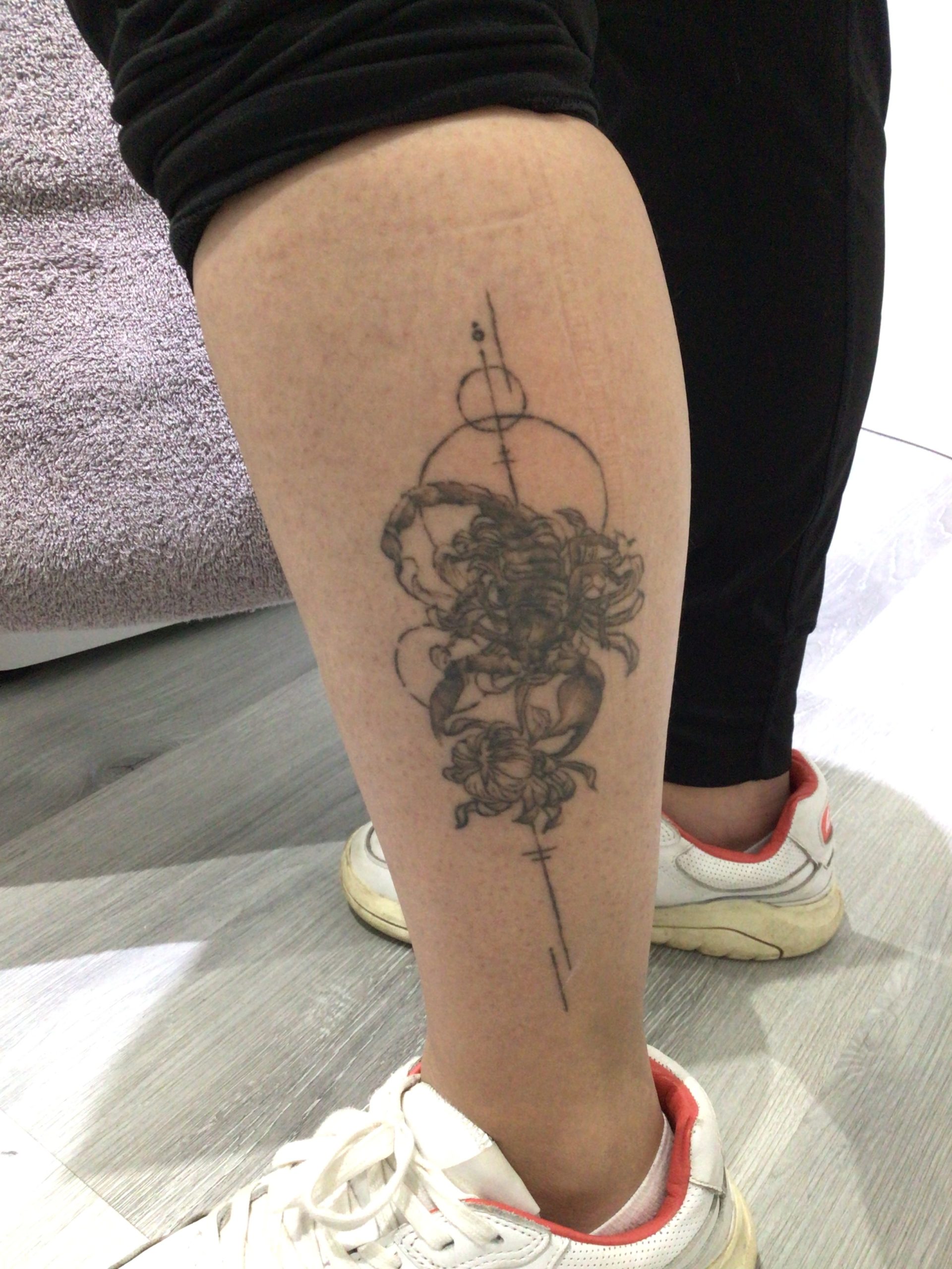 Scorpion tattoo before PicoWay removal
