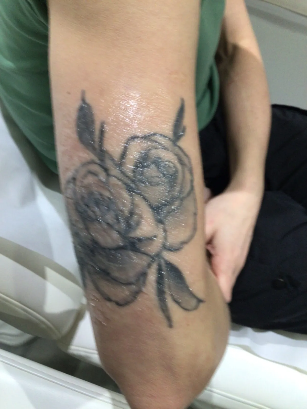 Rose tattoo before PicoWay removal