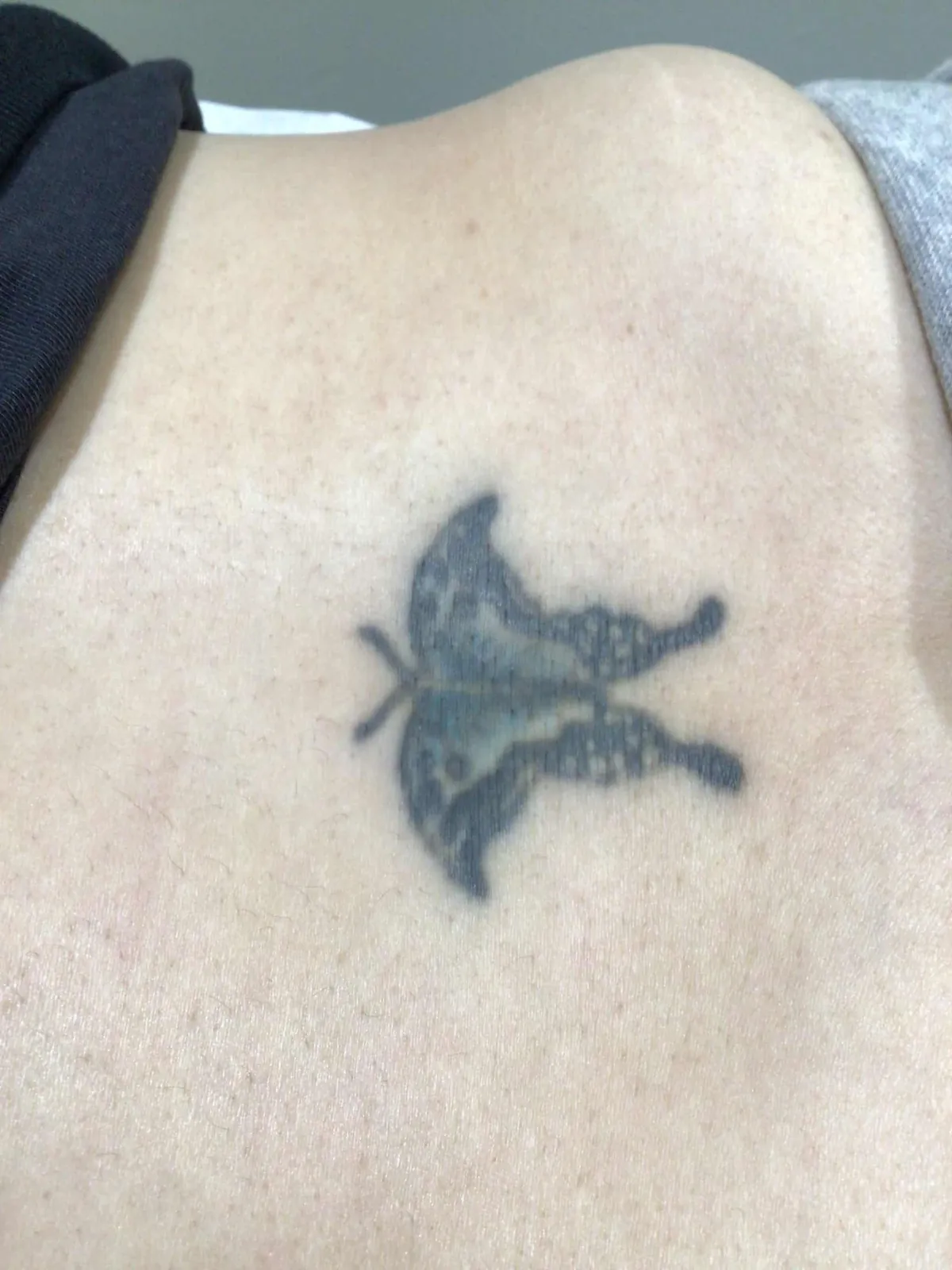 Butterfly tattoo before PicoWay removal